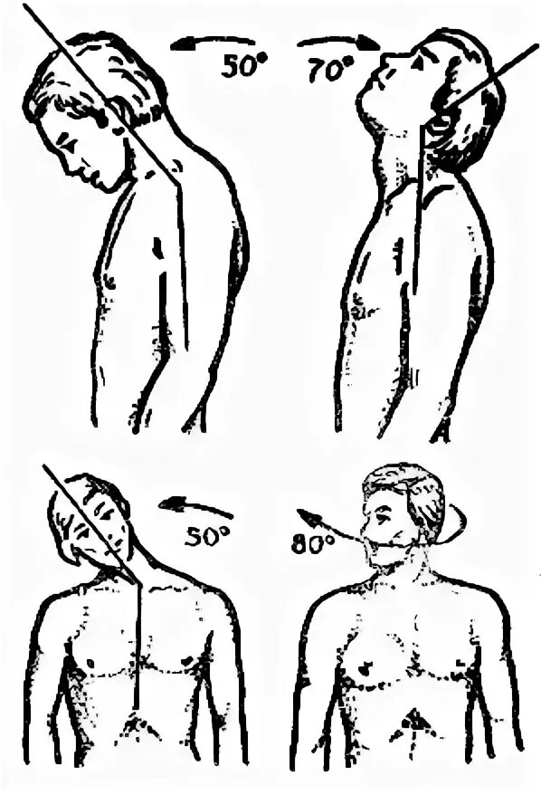 Гониометрия шейного отдела. Движения в шейном отделе. Подвижность шейного отдела. Подвижность шейных. Движения в шейном отделе.