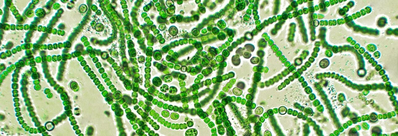 Цианобактерии бациллы. Фотосинтезирующие цианобактерии. Цианобактерии кислород. Цианобактерии нити. Группы организмов цианобактерии