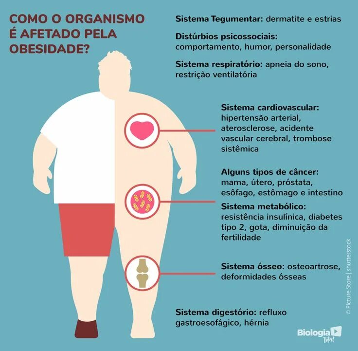 Инфографика для людей с ожирением. Ожирение плакат. Obesity related complications. Obesity symptoms. Избыточный вес.