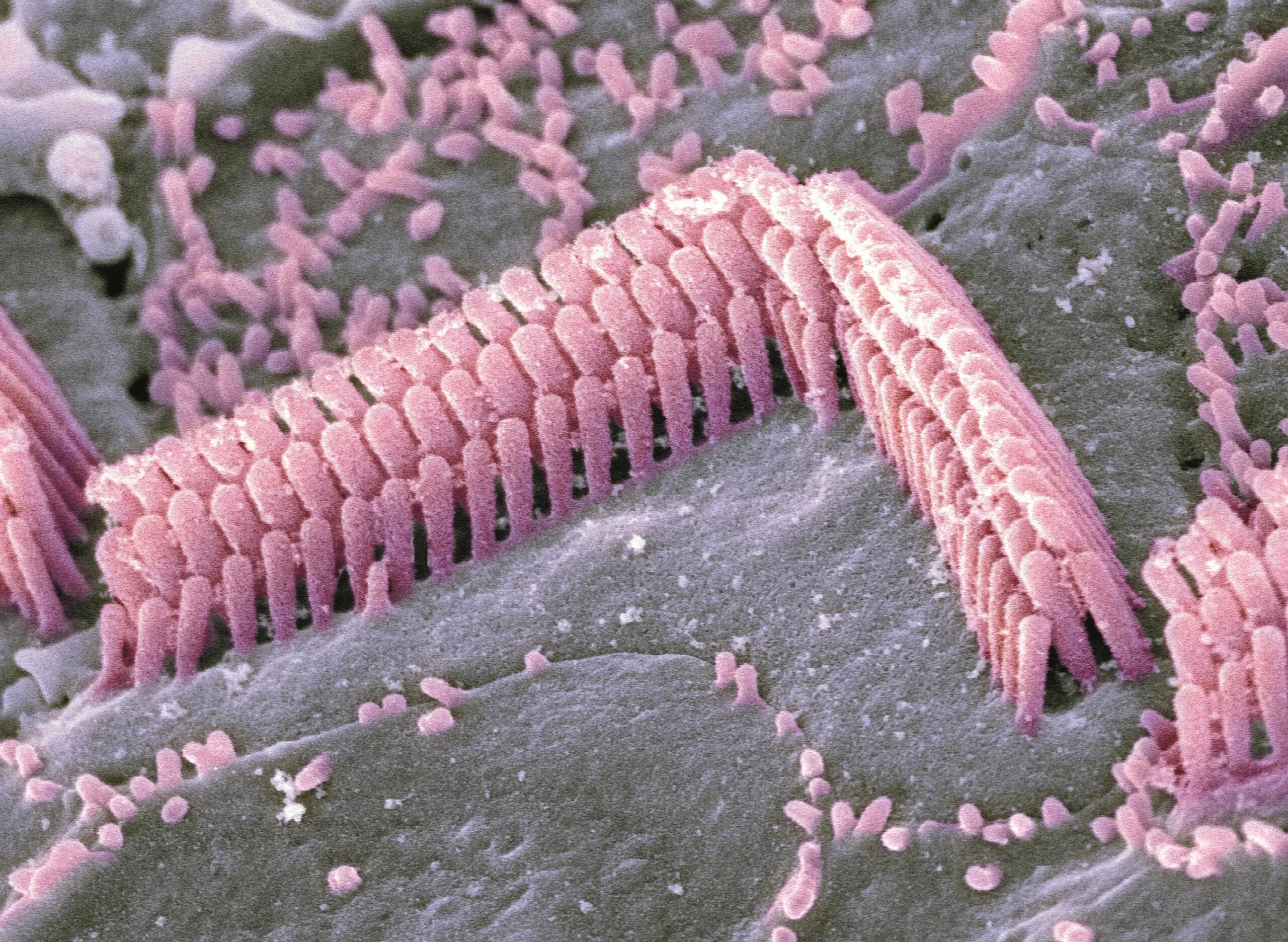 Волосковые клетки в рецепторах. Внутреннее ухо волосковые клетки. Волосковые клетки внутреннего уха электронная микроскопия.
