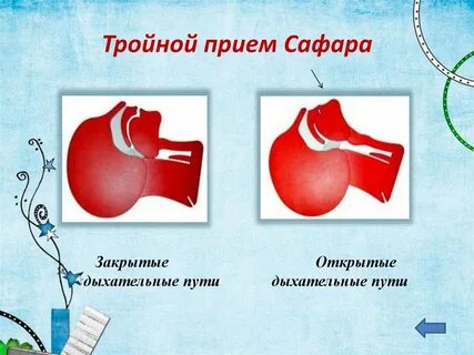 Прием сафара