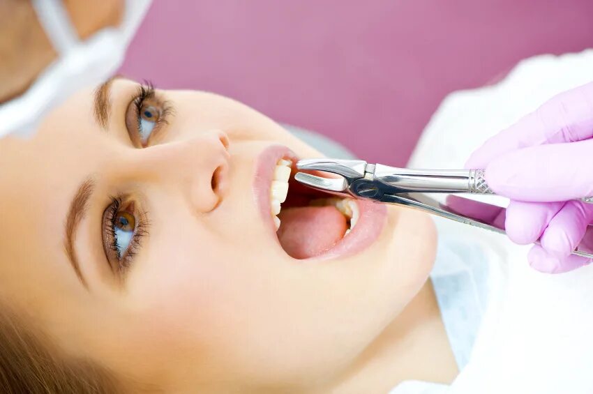 Tooth extraction