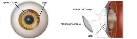 Роговица развивается