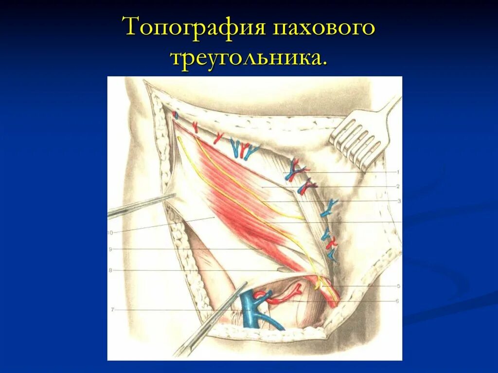 Паховая складка у мужчин. Паховый треугольник Гессельбаха. Паховый промежуток топографическая анатомия. Паховый треугольник топография пахового. Треугольник Гессельбаха паховая ямка.