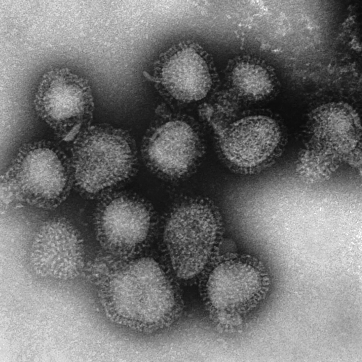 Грипп тип b. Вирус h1n1 испанка. вирус гриппа h1n1. вирус гриппа под микроскопом h1n1. вирусы под микроскопом.