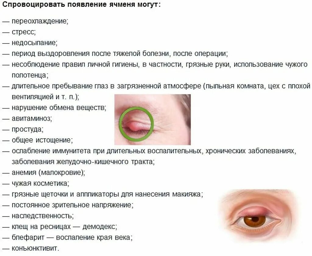Заболевания век ячмень. Этапы формирования ячменя на глазу.