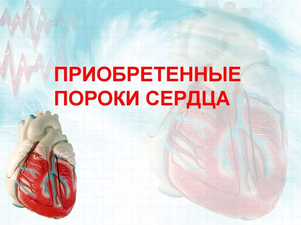 Патологическая анатомия приобретенных пороков сердца. Сердцем обретенная. Фото сердца. Приобретенные пороки сердца. Аномалии входных и выходных отверстий и клапанов сердца.