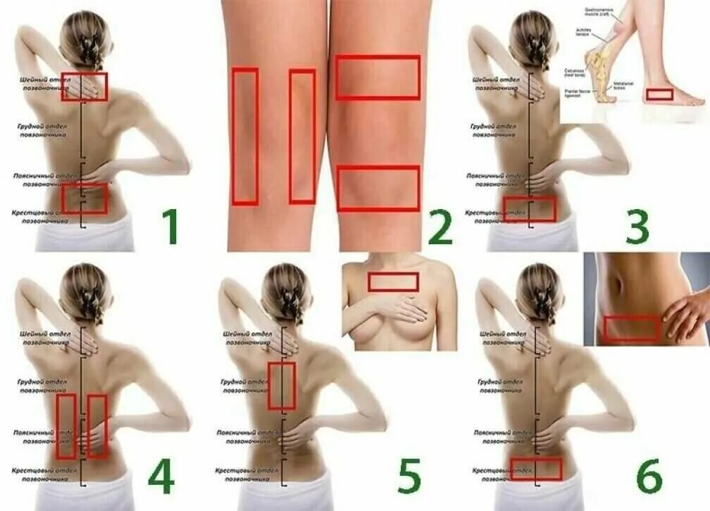 Перцовый пластырь на поясницу. Перцовый пластырь на шейный отдел позвоночника. Куда клеить перцовый пластырь. Пластыри куда можно клеить. Куда клеить пластырь на спину.