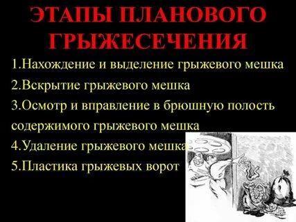 Вправление грыжи