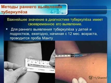 Тест проба туберкулез