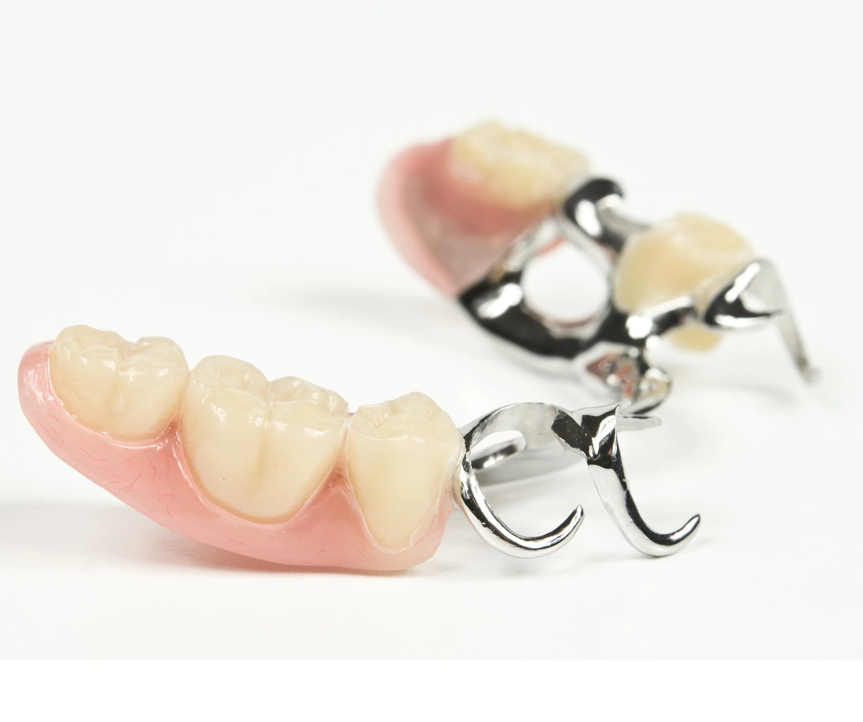 Бюгельный протез на аттачменах матрица и патрица. Односторонний бюгельный протез. Крепление бюгельных протезов. Нейлоновый бюгельный протез (квадротти). Крепление бюгельных протезов.