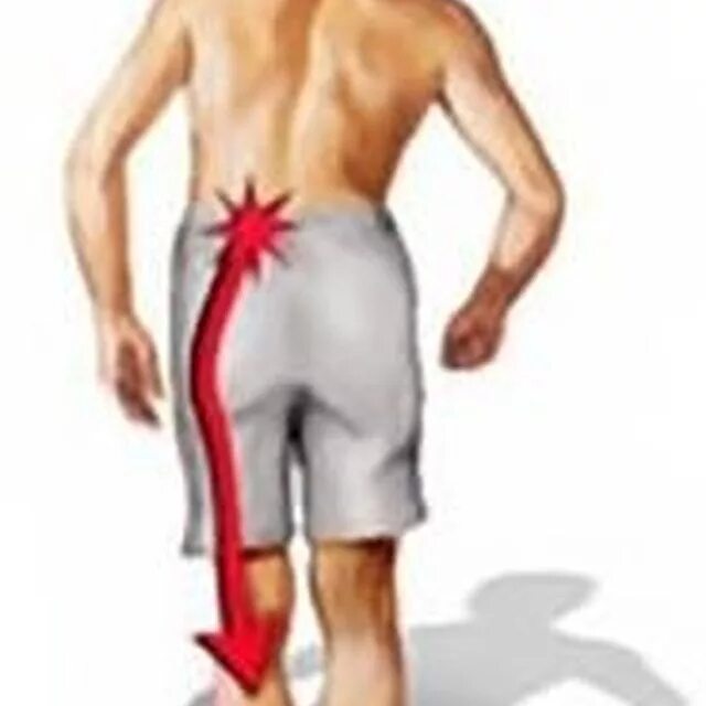 Болят ноги поясница болят бока. Боль в пояснице слева у мужчин. Боль в пояснице отдающая в левое бедро. Боль в области поясницы слева у мужчин. Боль в левом паху отдает в ногу.