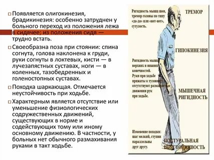 Ригидность мышц что это