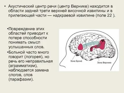 Акустическая речь