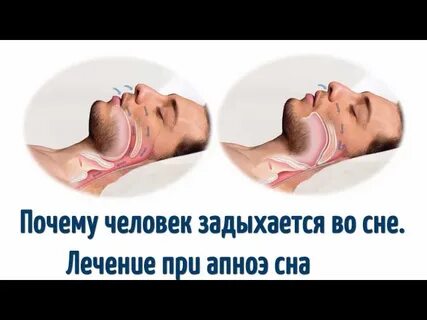 Когда спишь не хватает воздуха