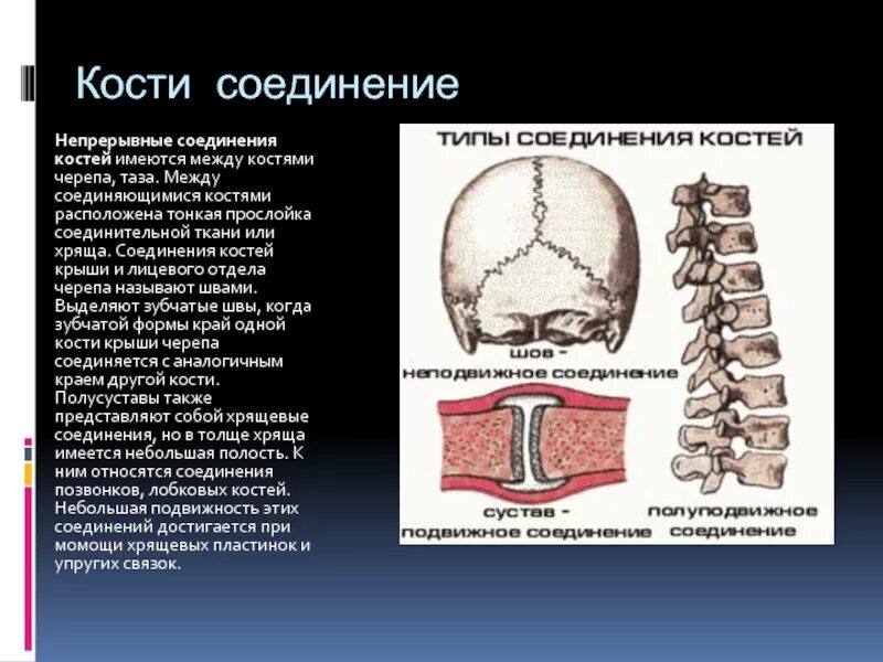 Соединение костей туловища и черепа. Непрерывные соединения черепа таблица. Соединение костей черепа швы. Типы соединения между костями.