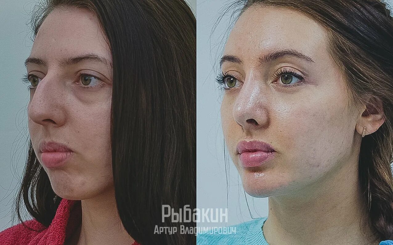 флер пластической хирургии. палаты в клиниках пластической хирургии. флер пластической хирургии.