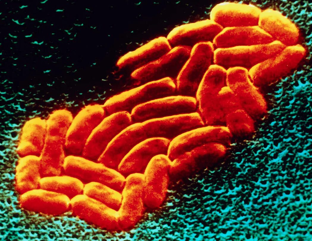 Болезнетворная бактерия палочка. Klebsiella pneumoniae, «палочка Фридлендера». Klebsiella pneumoniae под микроскопом. Клебсиелла пневмония под микроскопом.