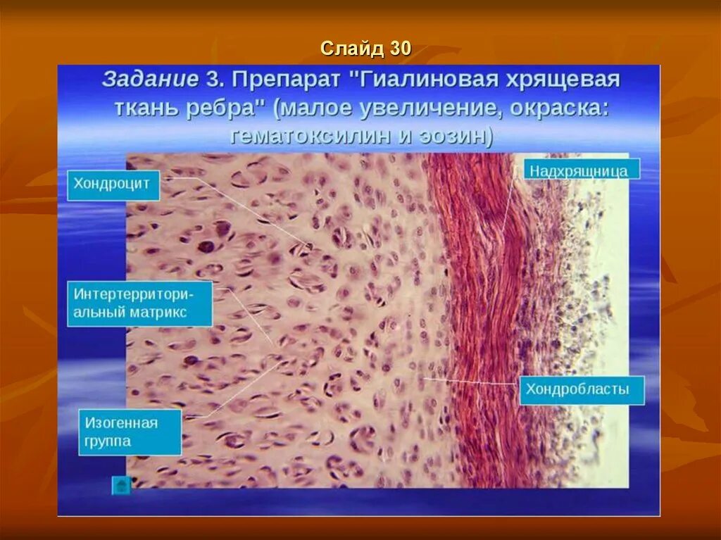 Изогенные группы. Волокнистый хрящ ткани гистология. Гиалиновая хрящевая ткань гистология. Хрящевая ткань гистология гиалиновый хрящ. Соединительная ткань гиалиновый хрящ.