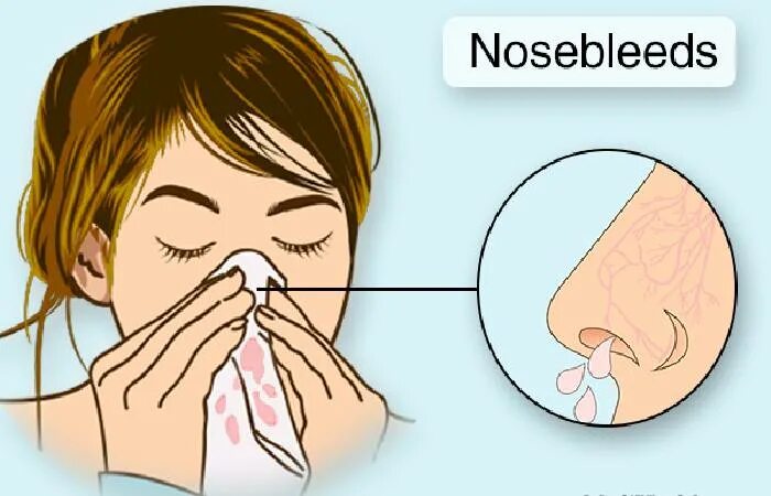 Matt mcclure nosebleed перевод. Matt mcclure nosebleed перевод