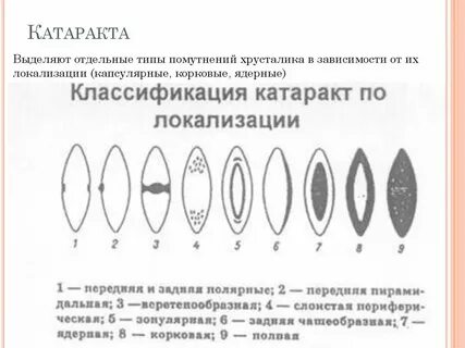 Катаракта клинические рекомендации