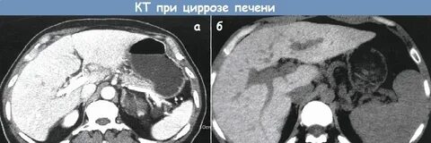 Диагноз кт