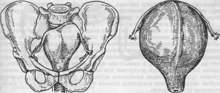 Признак пискачека. Признак Пискачека и Снегирева. Признак беременности Пискачека.