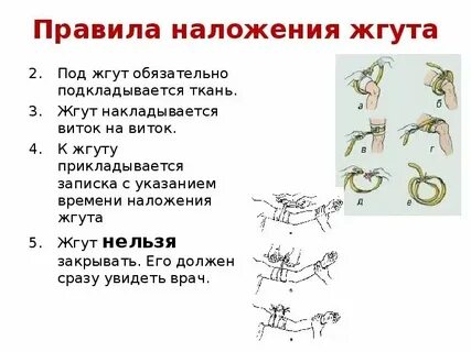 Время нахождения жгута на шее