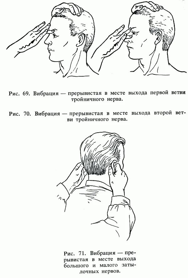 пальпация точек выхода тройничного нерва. точки выхода ветвей тройничного нерва. точки выхода тройничного нерва анатомия. пальпация тройничного нерва. точки выхода ветвей тройничного нерва.
