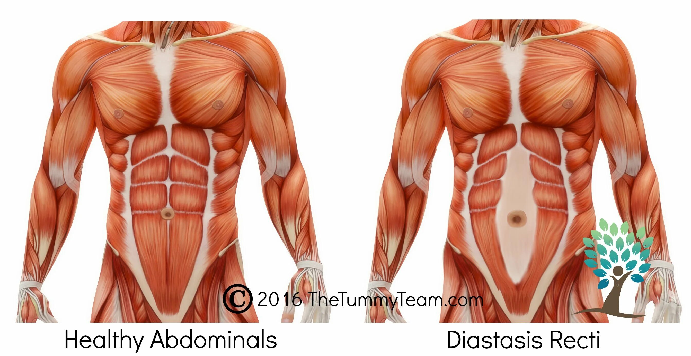 Прямые мышцы живота у мужчин. Мышцы пресса. Мышцы живота у мужчин. Мышцы пресса анатомия женщины.