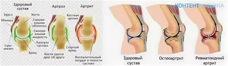 Артроз артрит у собак