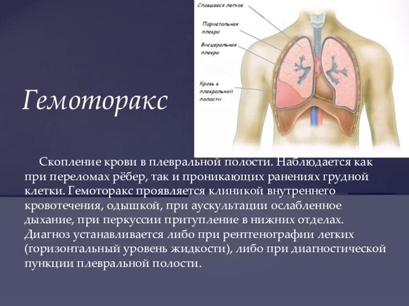 Повреждение легкого ребрами