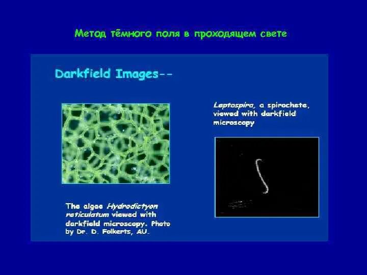 Микроскопия в проходящем и отраженном свете. Темнопольная микроскопия. Метод темного поля в микроскопии. Микроскопия в светлом поле, микроскопия в темном поле. Метод темного поля в проходящем свете.