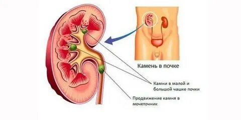 Анализы для почек у мужчин