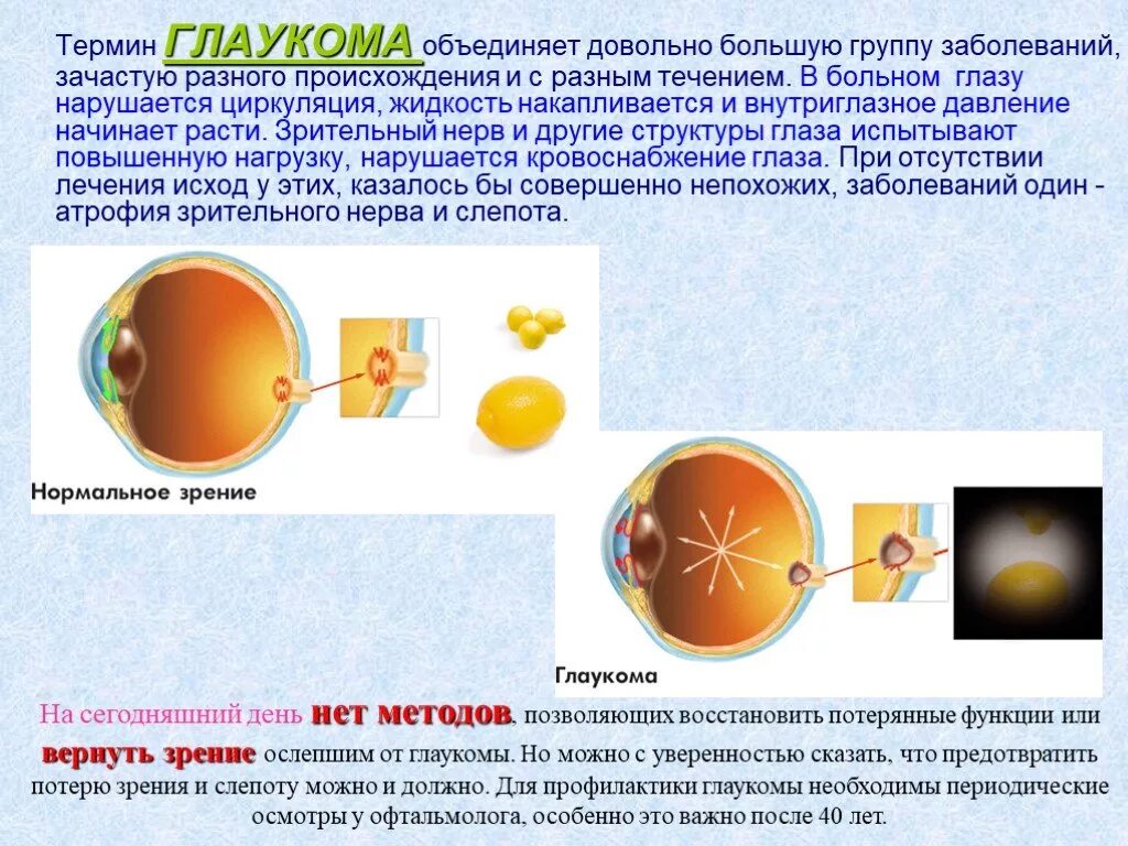 Нарушения зрения глаукома. Презентация на тему глаукома. Профилактика глаукомы презентация. Профилактика слепоты от глаукомы. Можно вернуть зрение при глаукоме