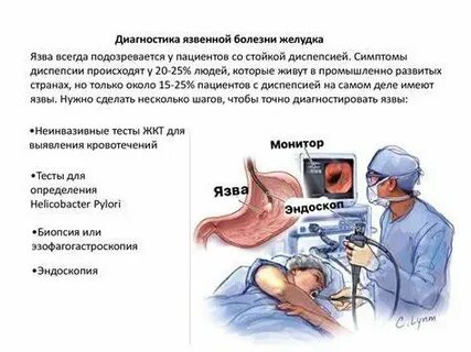 При обострении язвенной болезни