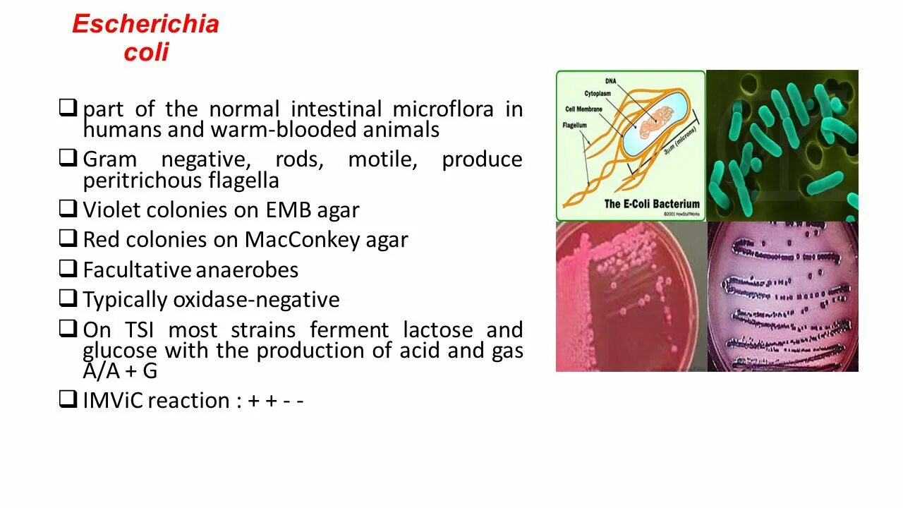 Coli sotwe. Бактерии эшерихия коли. Штамм бактерий Escherichia coli. Эшерихия коли заболевания. Эшерихия коли под микроскопом.