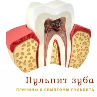 Пульп т