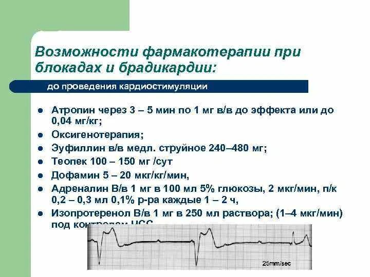 Брадикардия как поднять пульс