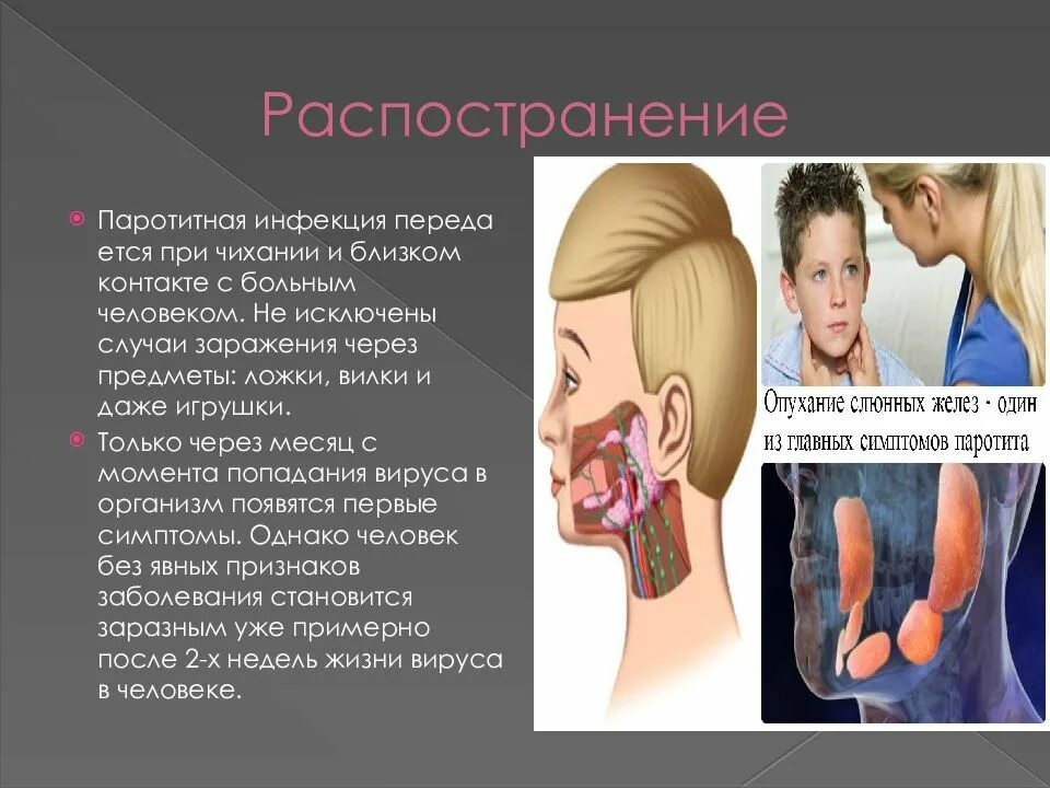 Паратит что это. Паротит у детей презентация.