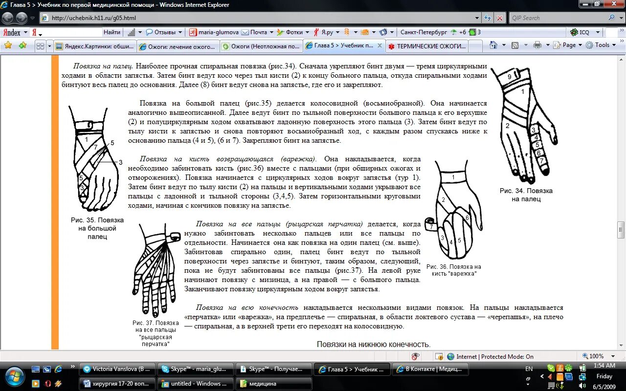 Наложение повязки варежка алгоритм. Наложение повязки на кисть варежка. Повязка при ожоге кисти. Возвращающаяся повязка на кисть варежка алгоритм. Повязка перчатка воришка.