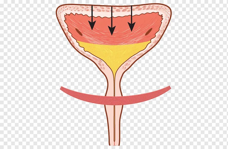 Гиперреактивный мочевой пузырь. Мочевой пузырь недержание. Мочевой пузырь рисунок. Зарисуйте мочевой пузырь. Прозрачное мочеиспускание