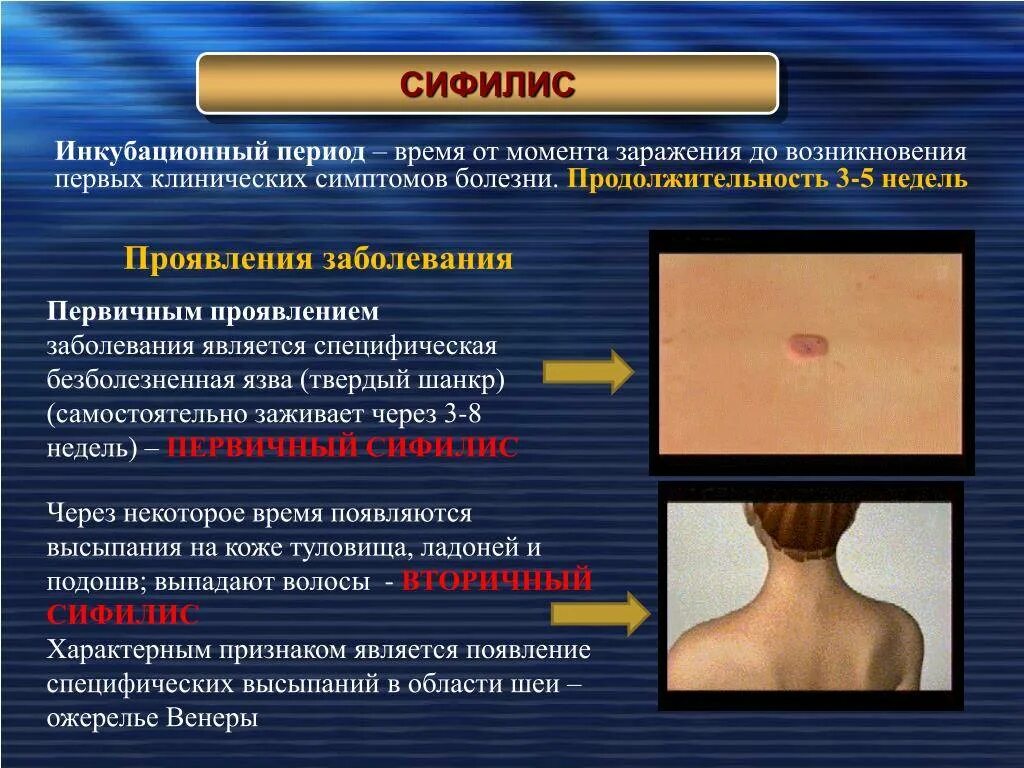 Появился почему появился симптом. Первичные проявления сифилиса. Кожные проявления сифилиса. Сифилитические проявления на коже. Венерические заболевания сифилис.