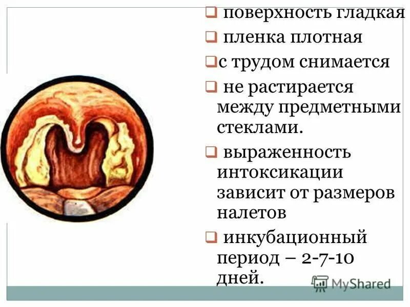 инкубационный период ангины у взрослых