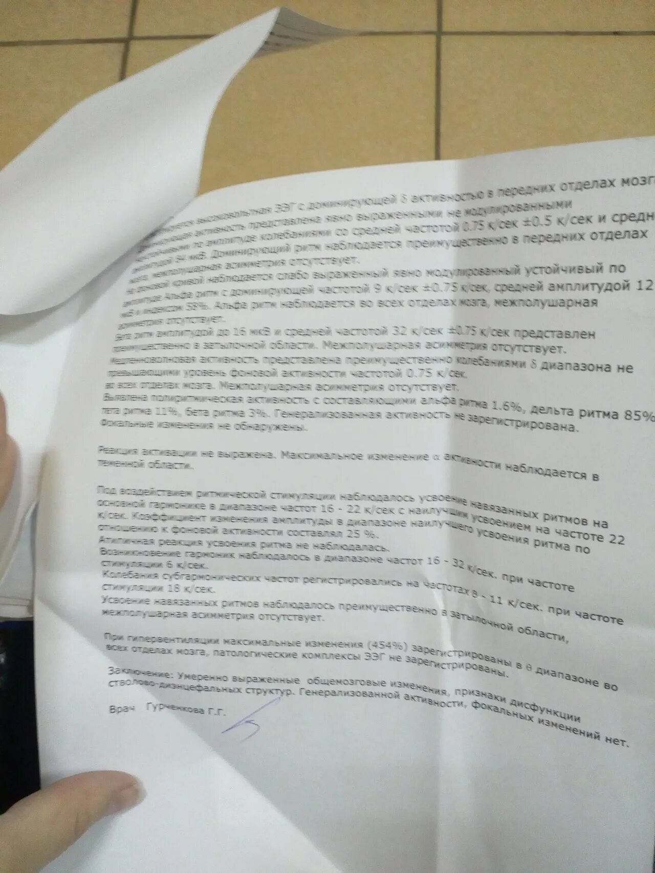 Дисфункция структур диэнцефального уровня. Дисфункция стволовых структур на ээг. дисфункция диэнцефальных структур. базально-диэнцефальные структуры. дисфункция диэнцефально-стволового уровня.