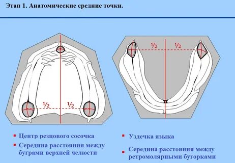 Ретромолярный треугольник