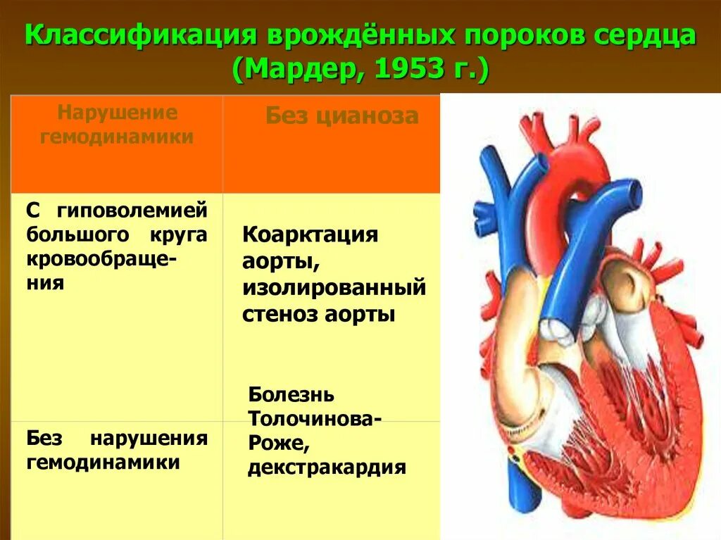 5 врожденных пороков сердца. Впс болезнь толочинова роже. врождённые пороки сердца гемодинамикк. толчивова роже порок сердца. классификация впс.