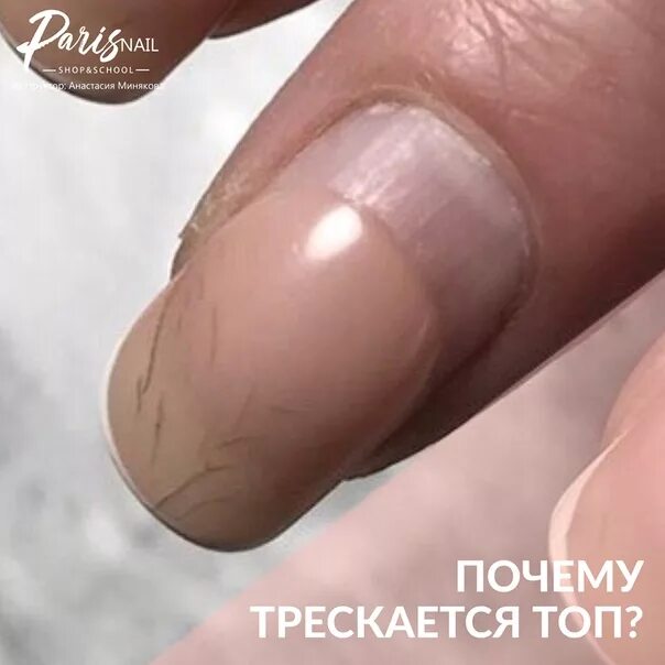 Почему трескается гель. Трещина на ногте гель лак. трескающийся гель лак.