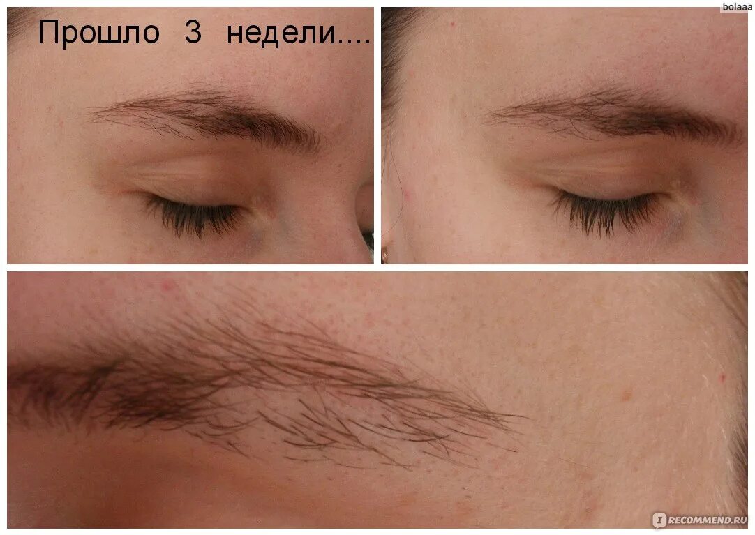 Процесс отращивания бровей. Отрастить брови фото до и после. Отращивание бровей до и после. Как быстро отрастить брови. Отросшие брови.