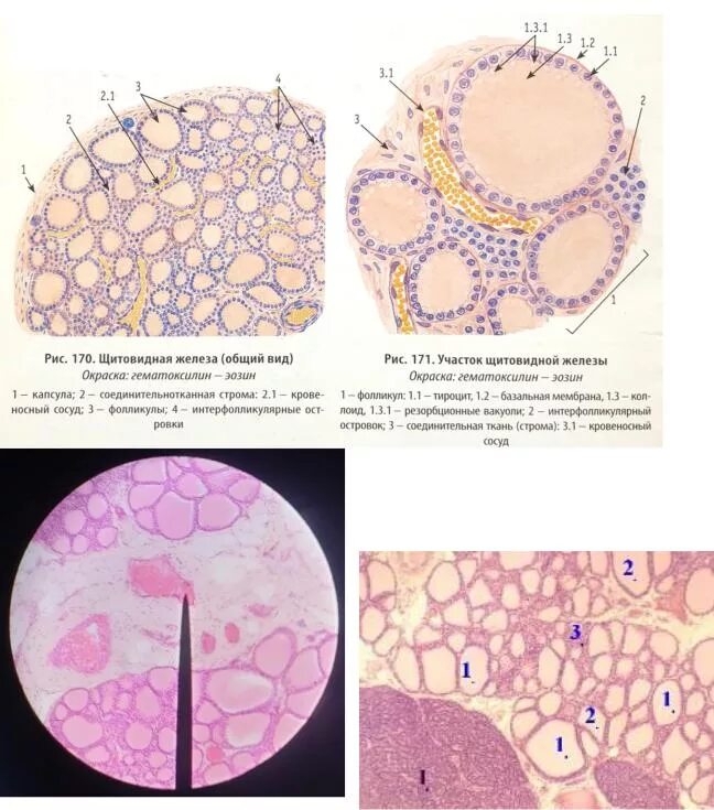 Щитовидная железа препарат гематоксилин-эозин гистология. Препарат – щитовидная железа. Окраска гематоксилин-эозином.. Щитовидная железа гистология препарат. Щитовидная железа собаки гистология препарат.